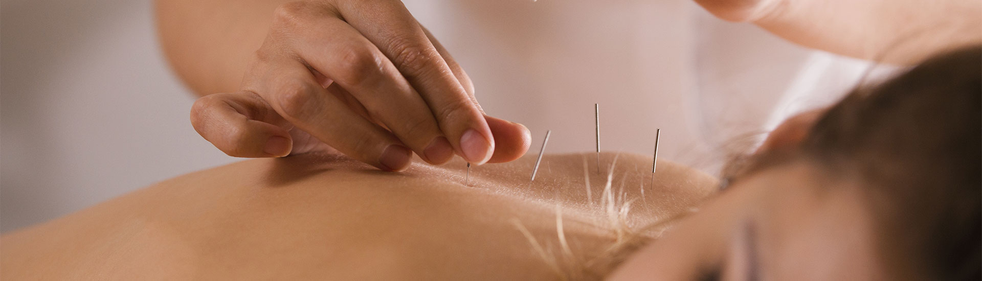 Acupuntura China Medicina Oriental en Las Condes