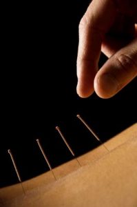 Acupuntura China Medicina Oriental en Las Condes